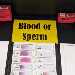 An image of slides with cells categorized as "Blood" or "Sperm."